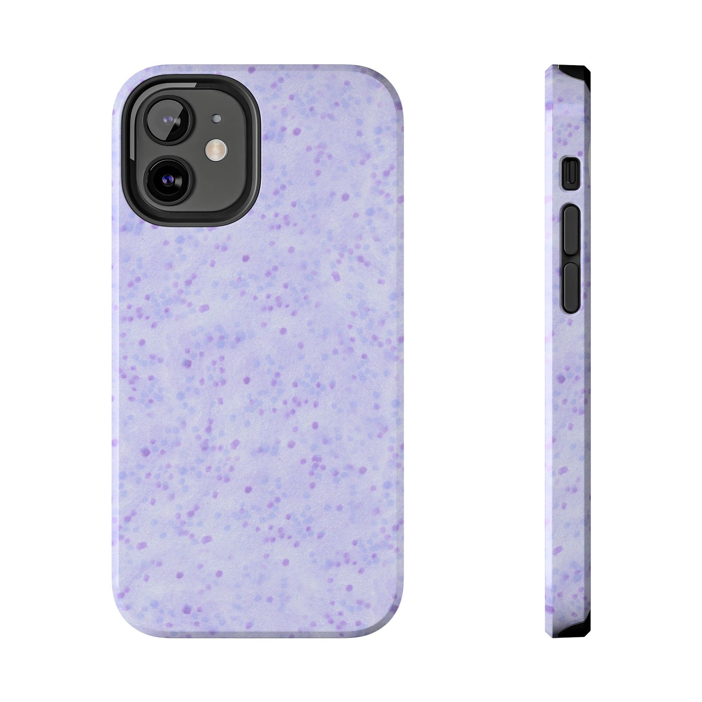 Fairy Freckles Lilac Phone Case